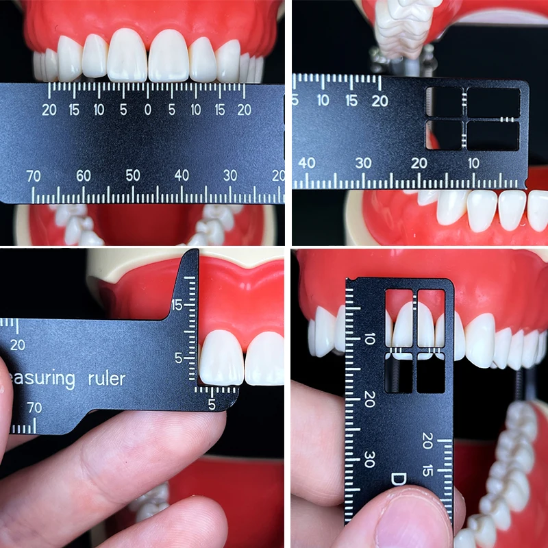 Photography Rules - Autoklawowalna precyzyjna linijka dentystyczna do pomiaru